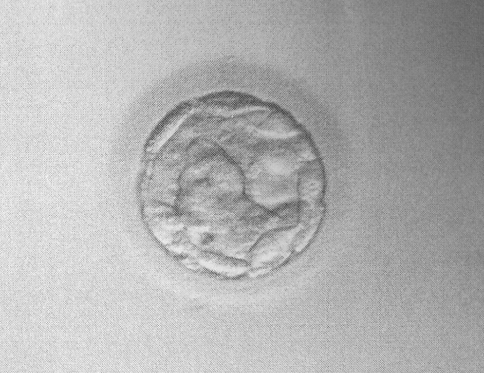 blastocyst Ebbas